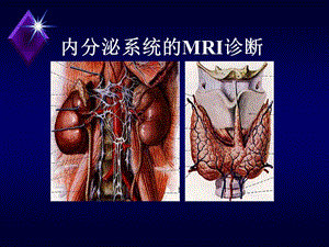 内分泌系统疾病的MRI诊断.ppt