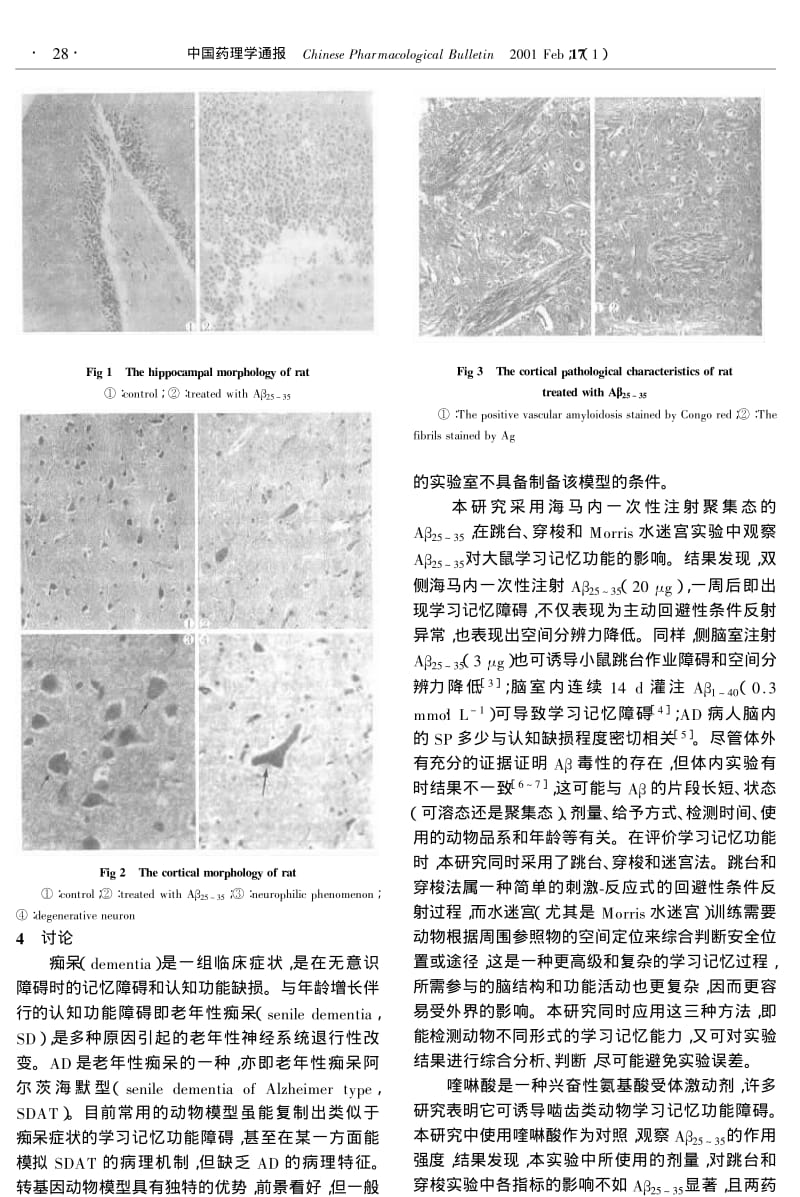 β-淀粉样多肽25～35片段诱导的大鼠学习记忆功能障碍.pdf_第3页