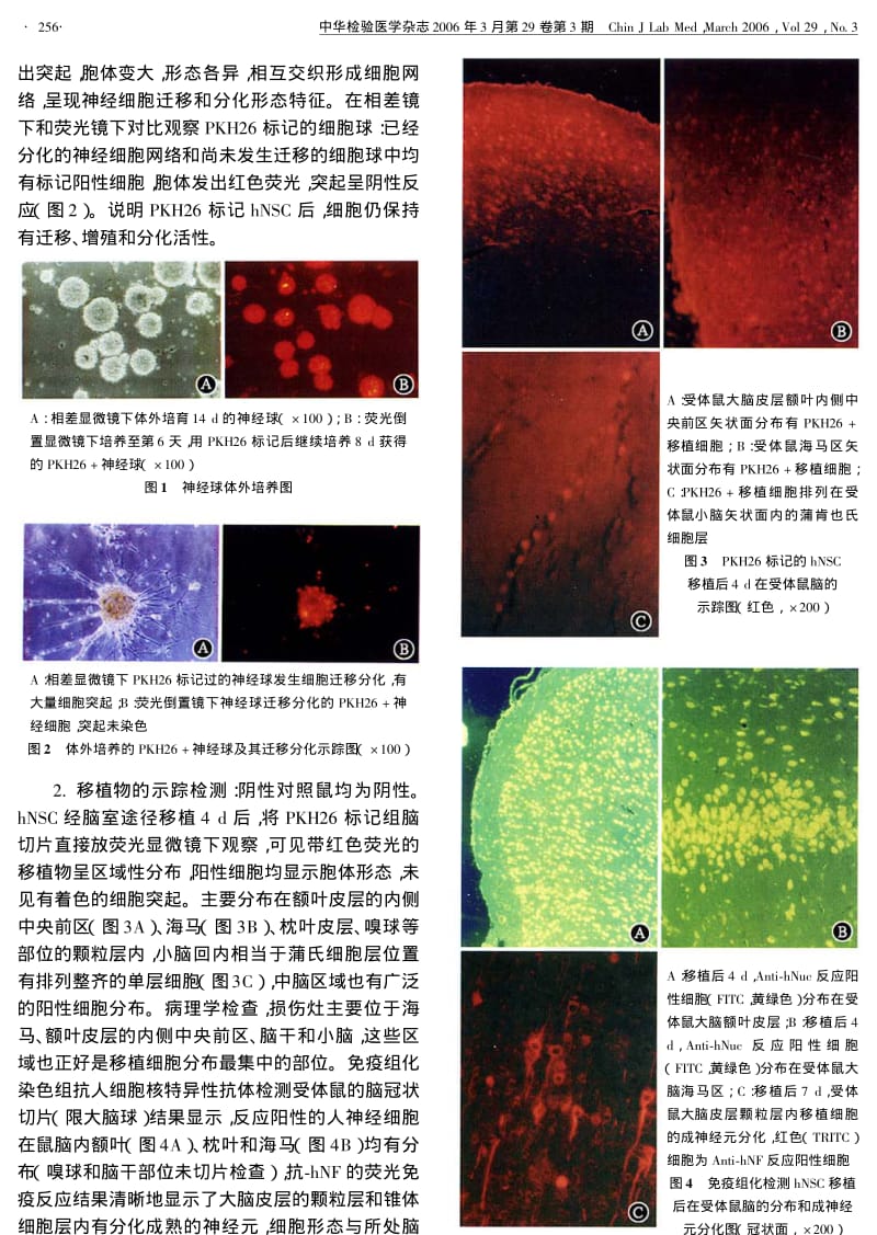 人神经干细胞异种移植示踪检测分析.pdf_第3页