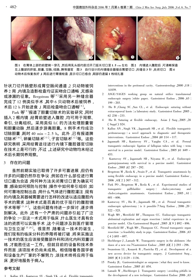 经口经胃壁腹腔镜技术的研究进展.pdf_第2页