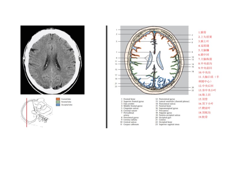 颅脑CT对照图谱.doc_第2页