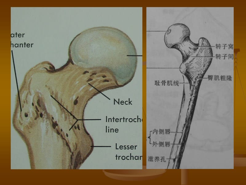 股骨头坏死的影像学诊断;.ppt_第3页