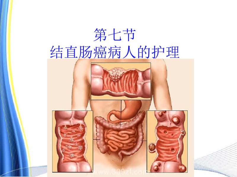 胃肠疾病病人的的护理.pdf_第3页