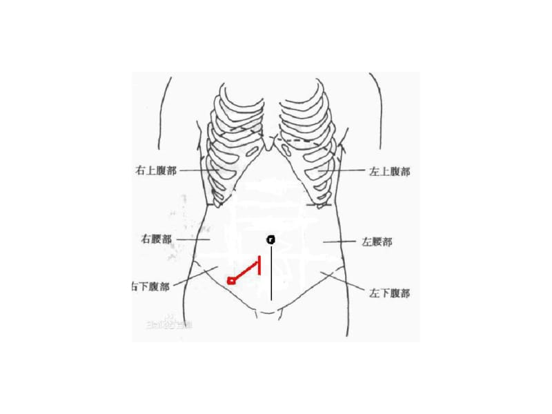 腹膜透析置管术的区域神经阻滞课件.pdf_第2页