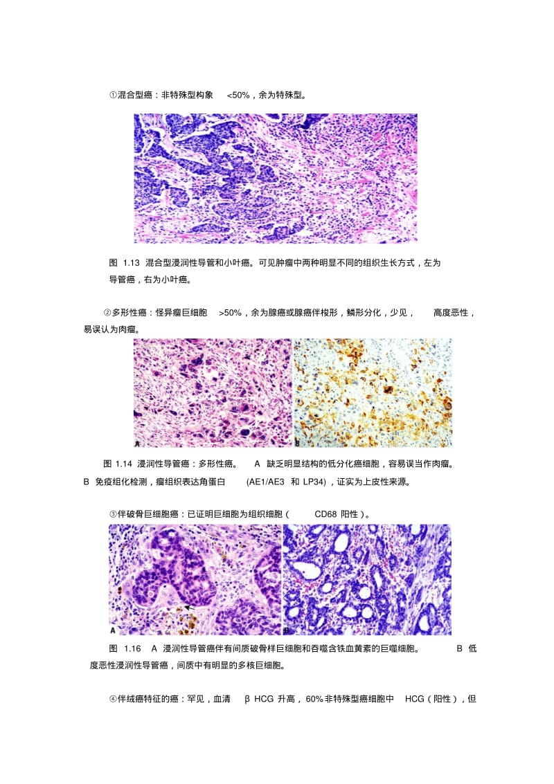 WHO乳腺肿瘤组织学分类-9月1日.pdf_第2页