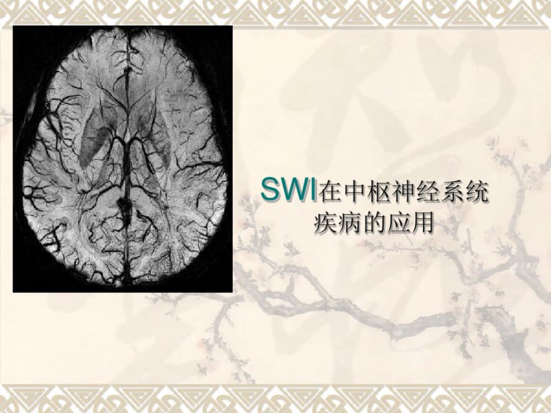 swi在中枢神经系统应用课件-医学精品.pdf_第1页