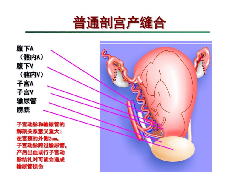 剖宫产手术缝合技术讲解.pdf_第2页