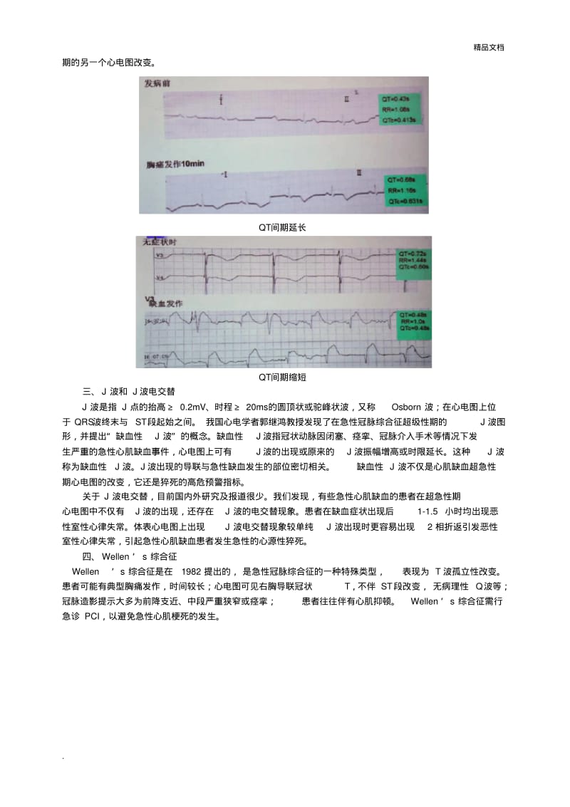 心肌缺血心电图分析.pdf_第2页