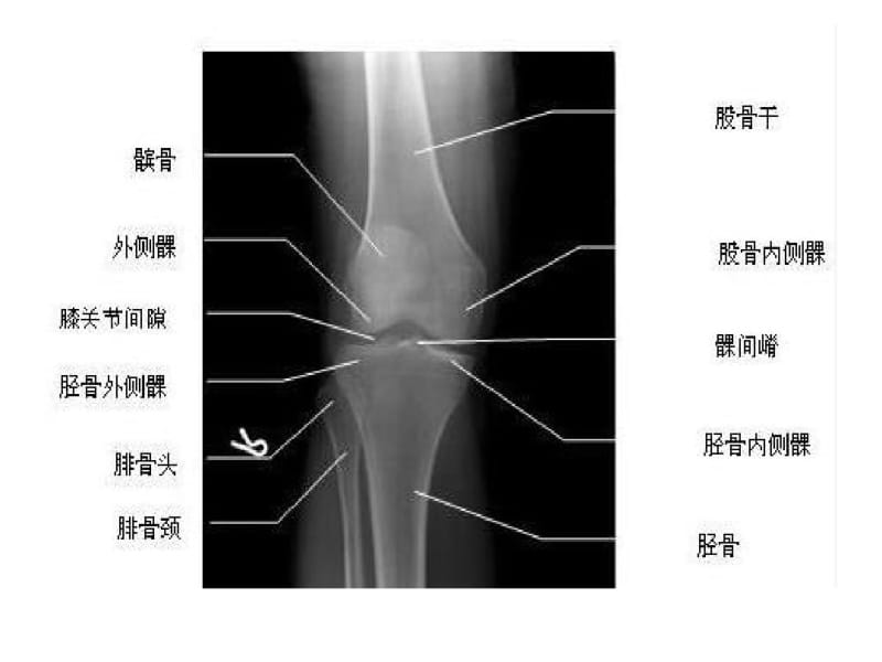 正常膝关节超声检查.pdf_第2页