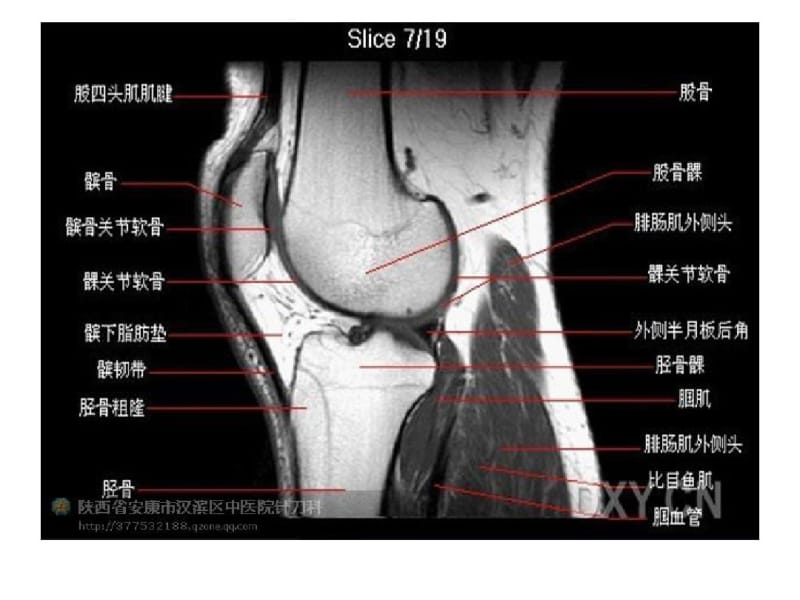 正常膝关节超声检查.pdf_第3页