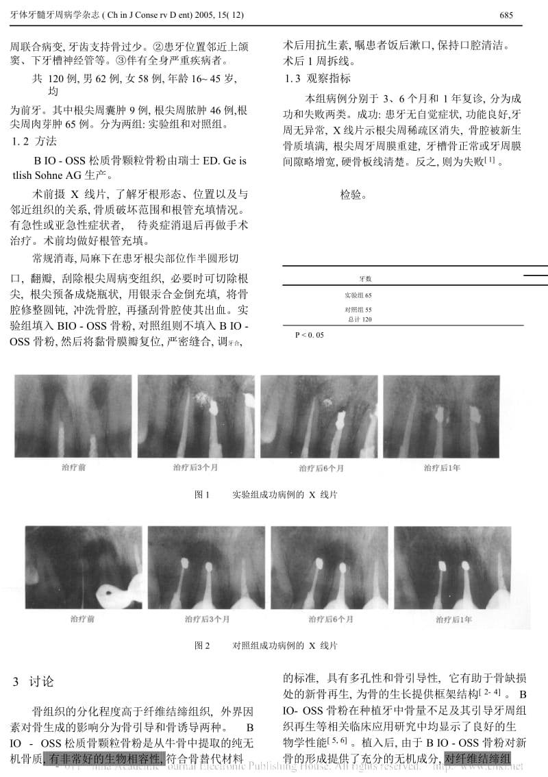 BIO_OSS促进根尖周刮治术后骨缺损修复的临床效果_张筱薇 (1).docx_第3页