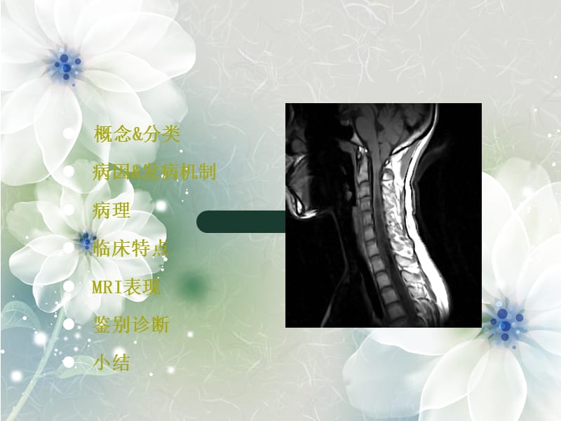脊髓空洞症MRI表现.ppt_第2页