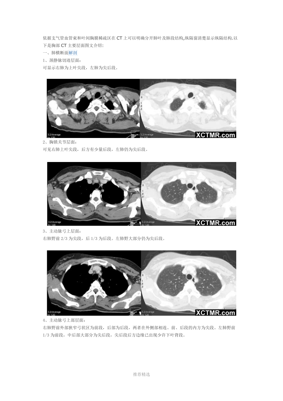 胸部CT断层解剖.doc_第1页