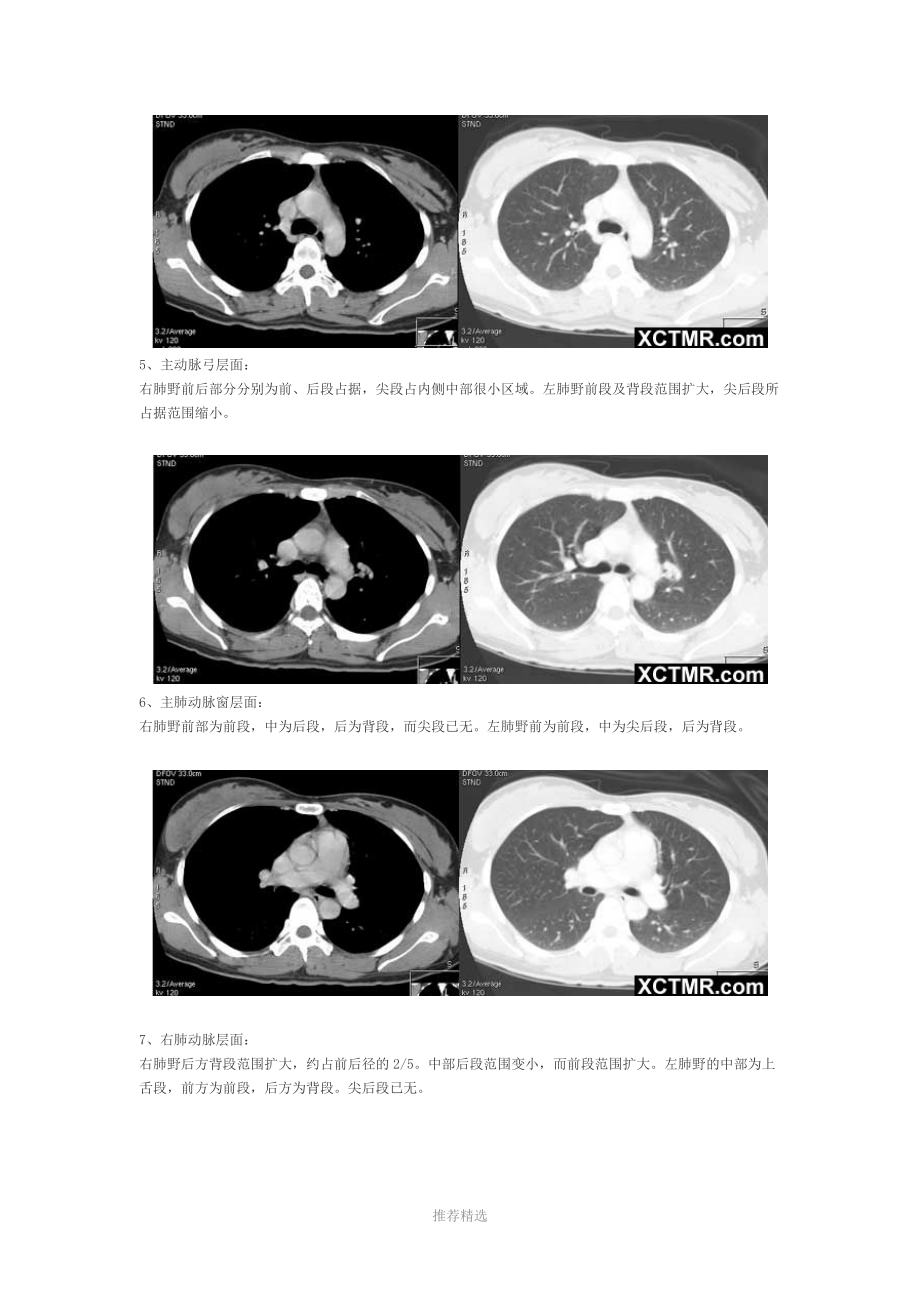 胸部CT断层解剖.doc_第2页