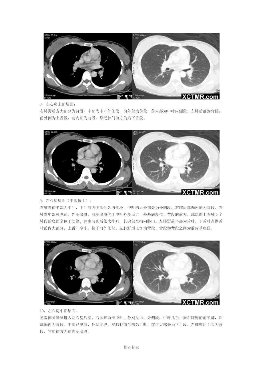 胸部CT断层解剖.doc_第3页
