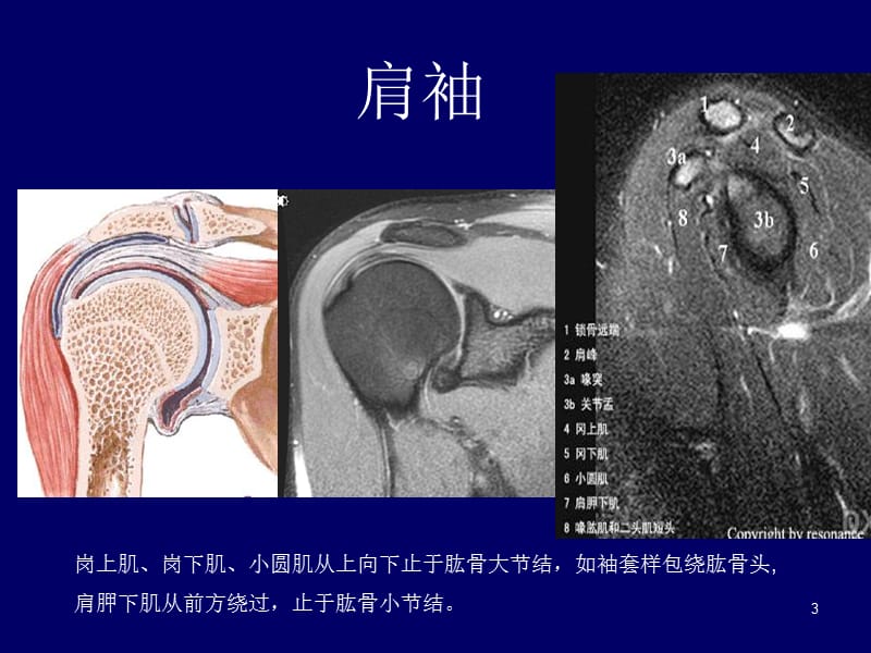 （推荐精选）肩关节应用解剖及腱鞘肌腱病的磁共振影像诊断.ppt_第3页