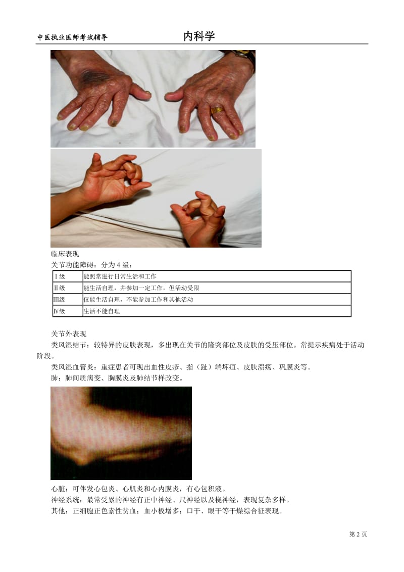 中医执业医师内科学讲义：结缔组织病.doc_第2页