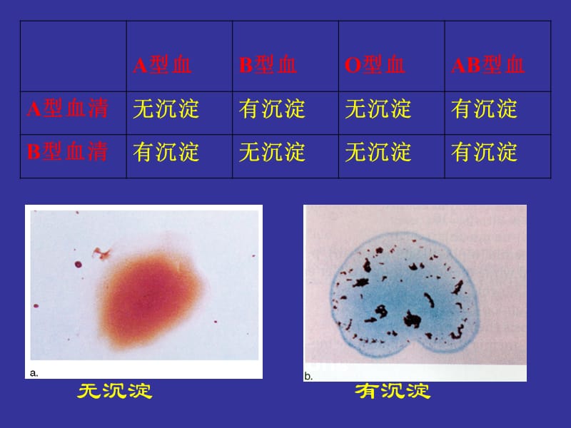 4-9-1-2血液模拟血型鉴定.ppt_第3页