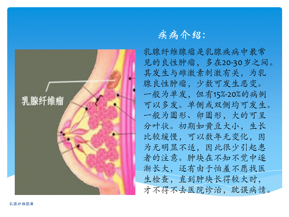 最新乳腺纤维腺瘤.ppt_第2页