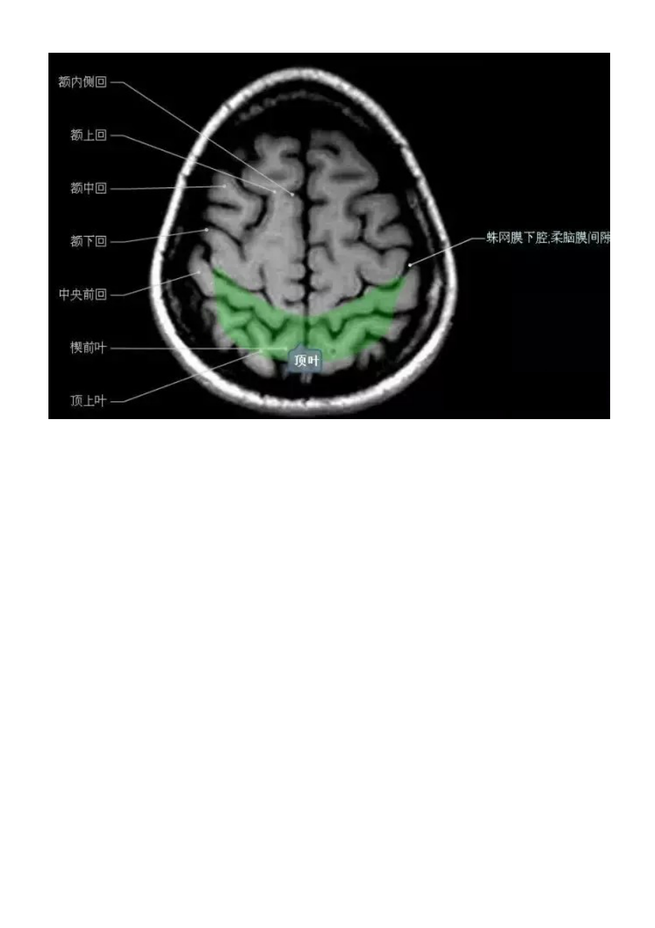 正常颅脑磁共振图示.docx_第2页