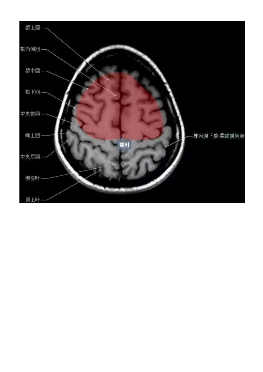 正常颅脑磁共振图示.docx_第3页