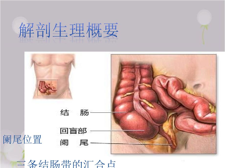 急性阑尾炎PPT课件.pptx_第3页