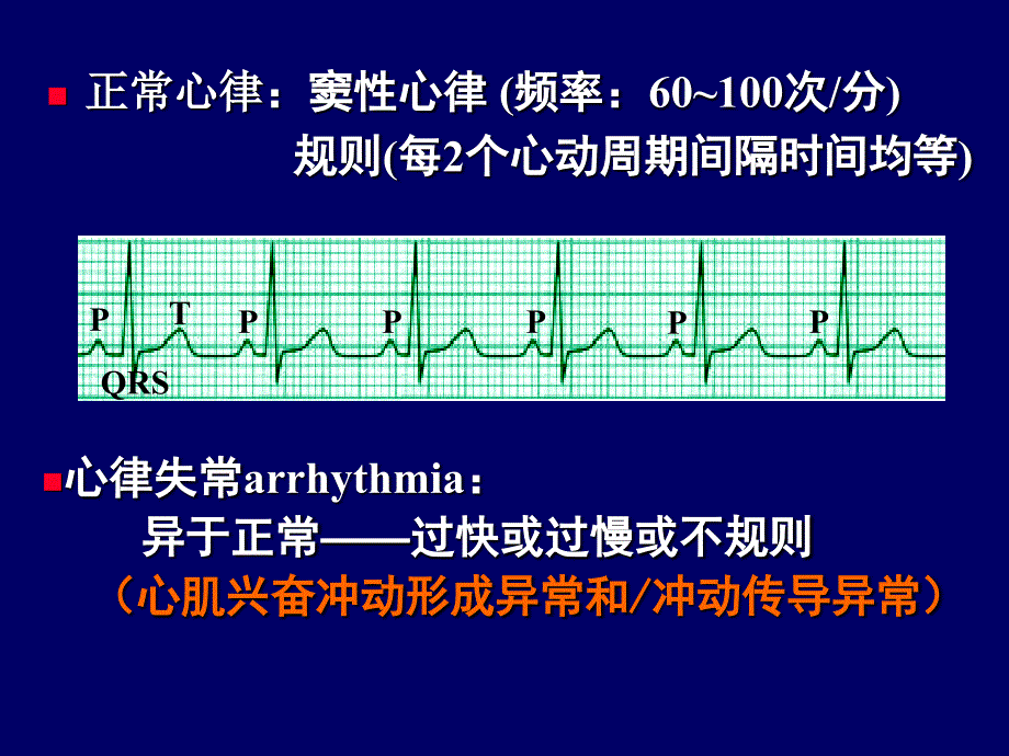 抗心律失常药PPT课件.ppt_第2页