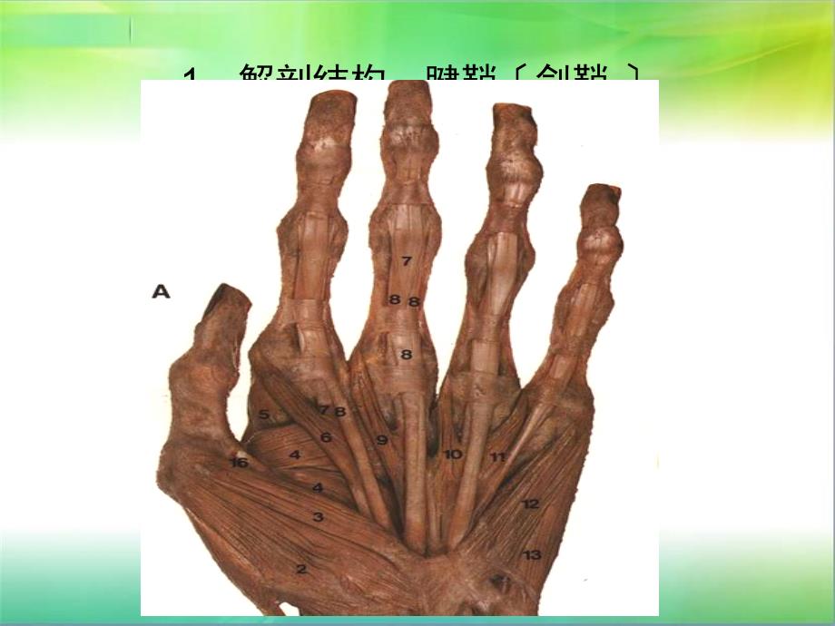 小针刀治疗腱鞘炎PPT课件.ppt_第3页