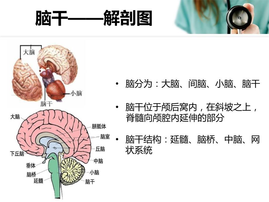 延髓梗塞课件.ppt_第2页