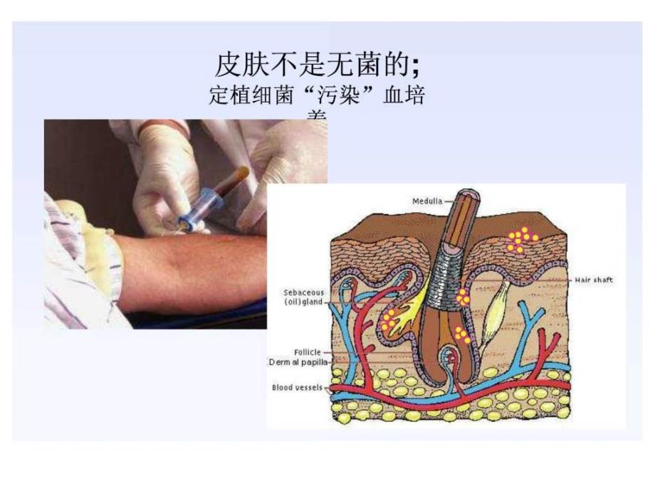 明确血培养的临床意义.ppt.ppt_第2页