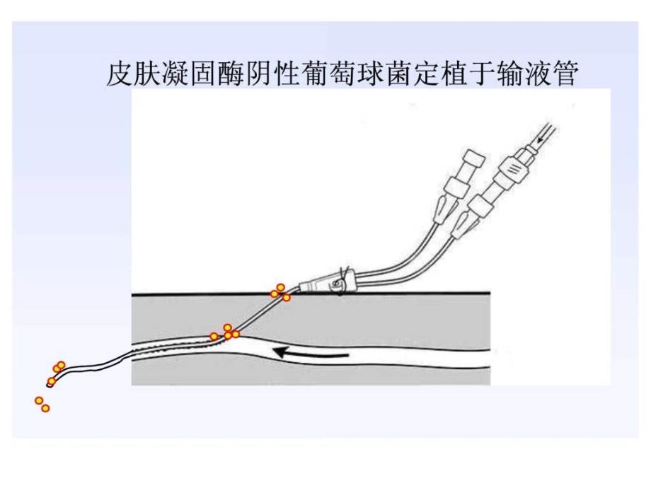 明确血培养的临床意义.ppt.ppt_第3页