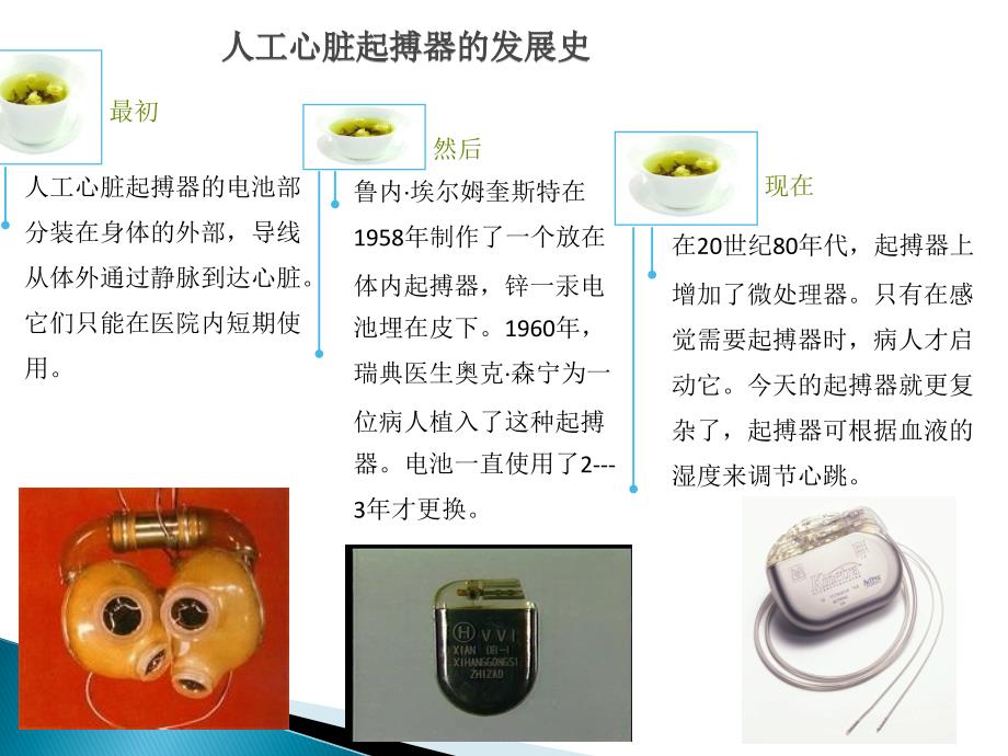 心脏起搏器术前术后护理要点.ppt_第3页