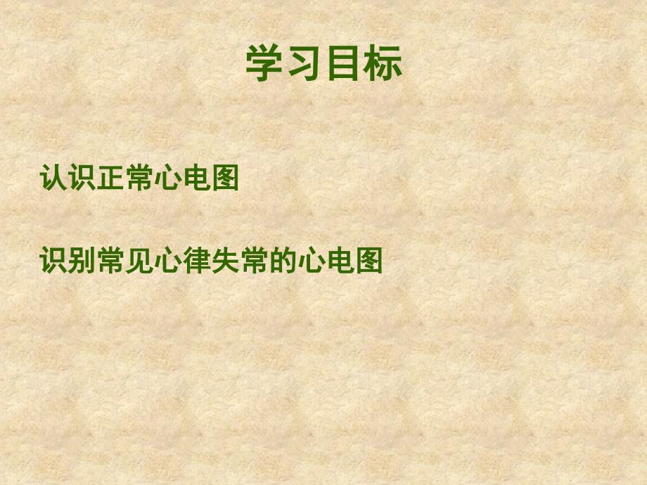 常见心律失常的心电图识别.ppt_第2页