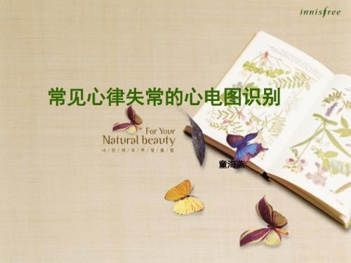 常见心律失常的心电图识别.ppt