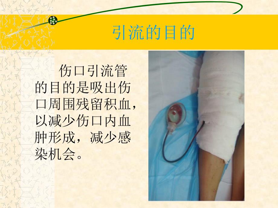 引流管的观察及护理.ppt_第3页