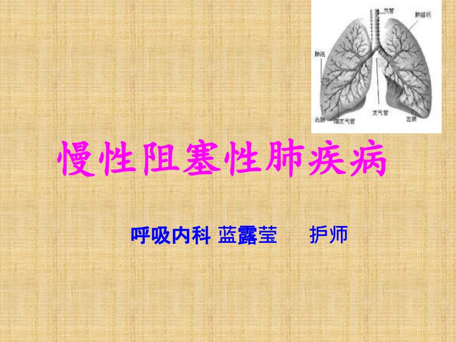 慢阻肺课件.ppt.ppt_第1页