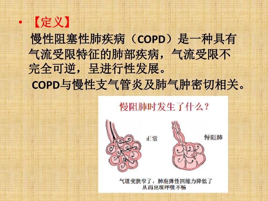 慢阻肺课件.ppt.ppt_第2页