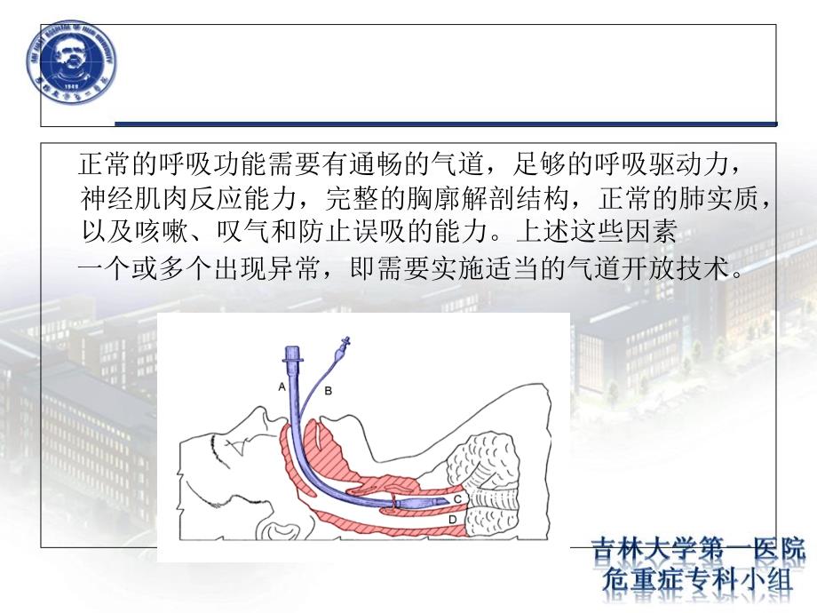 气道开放技术.ppt.ppt_第3页