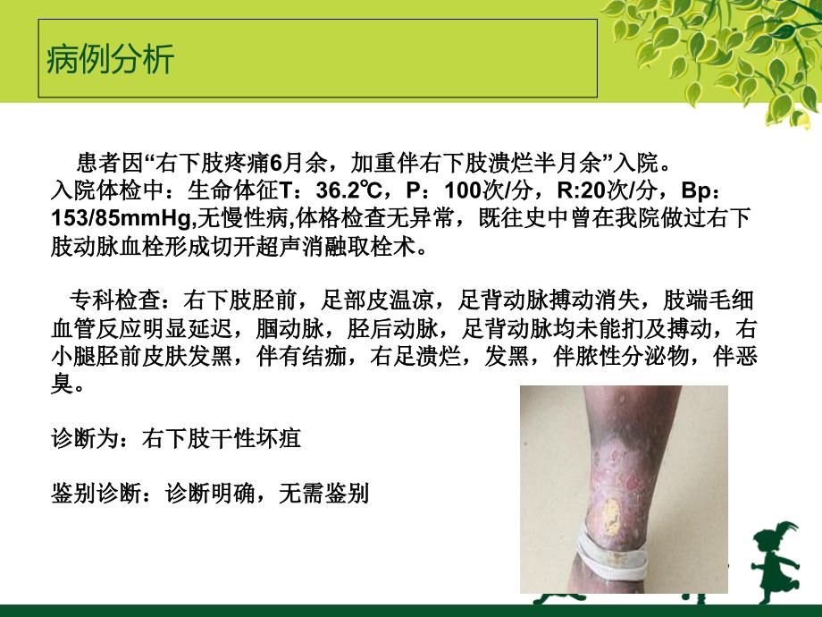 干性坏疽的护理查房.ppt_第3页