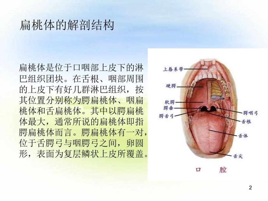 扁桃体手术配合PPT参考幻灯片.ppt_第2页