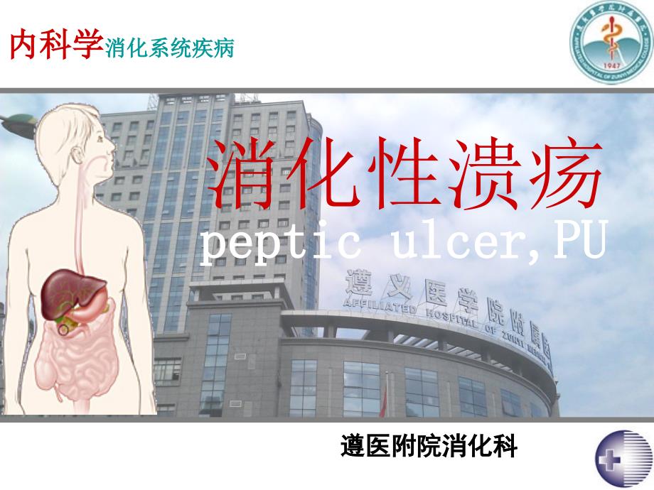 消化性溃疡的病因发病机制.ppt_第1页