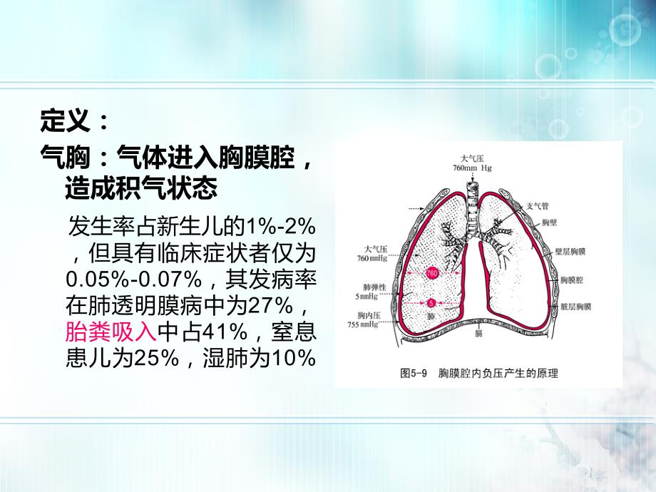 新生儿气胸.ppt_第3页