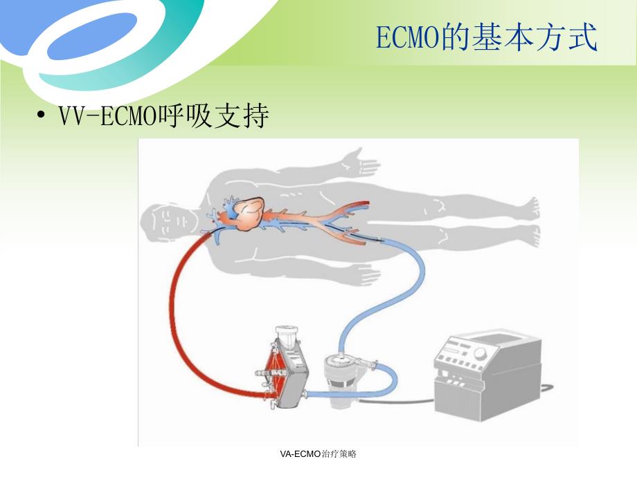 最新VAECMO治疗策略.ppt_第3页