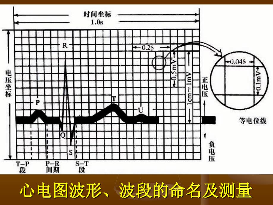 异常心电图的识别PPT课件.ppt_第3页
