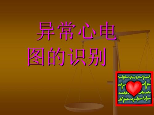 异常心电图的识别PPT课件.ppt