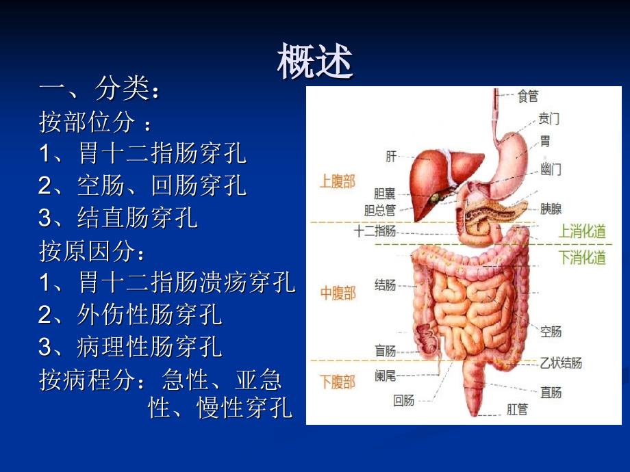 消化道穿孔资料课件.ppt_第3页