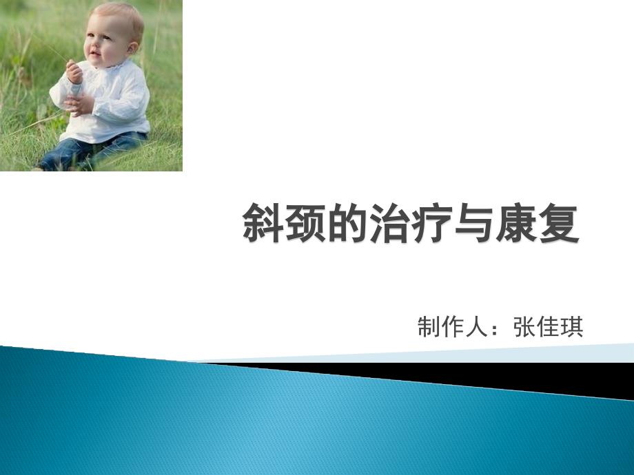 斜颈的治疗.pptx_第1页