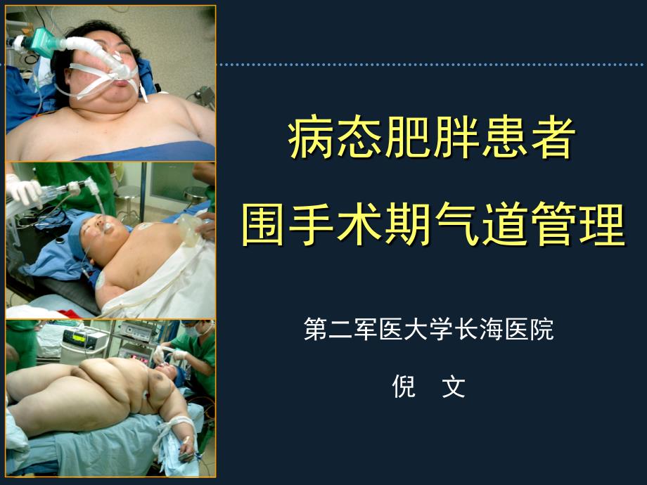 病态肥胖患者围手术期的的气道管理长海麻醉周倪文.ppt_第1页