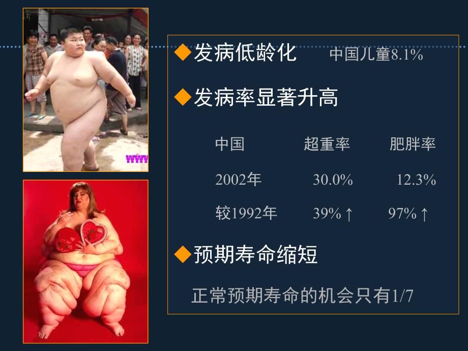 病态肥胖患者围手术期的的气道管理长海麻醉周倪文.ppt_第2页