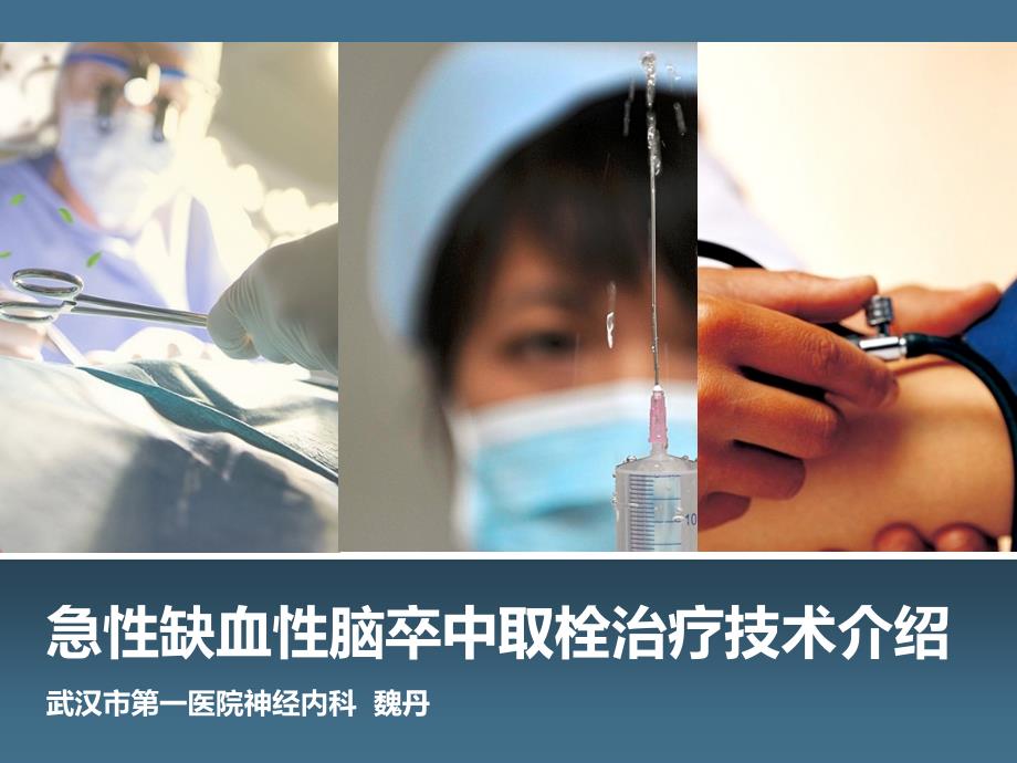 急性缺血性脑卒中取栓治疗技术.ppt_第1页